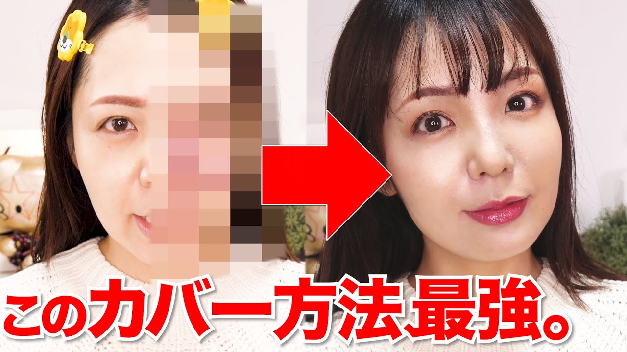 【永久保存版】最強カバーメイク！アザカバー歴30年の私の集大成【濃いアザ/ニキビ跡/シミも対応】