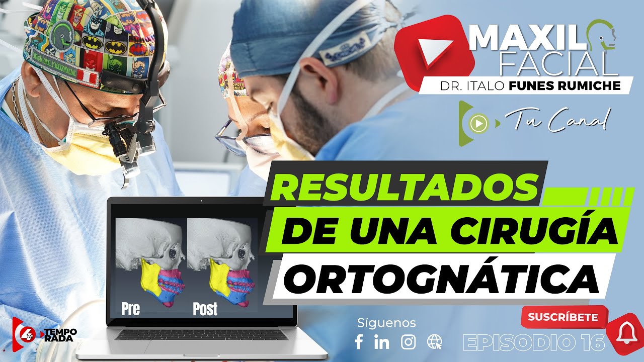 ⚡ Resultados de una ⇨ CIRUGÍA ORTOGNÁTICA
