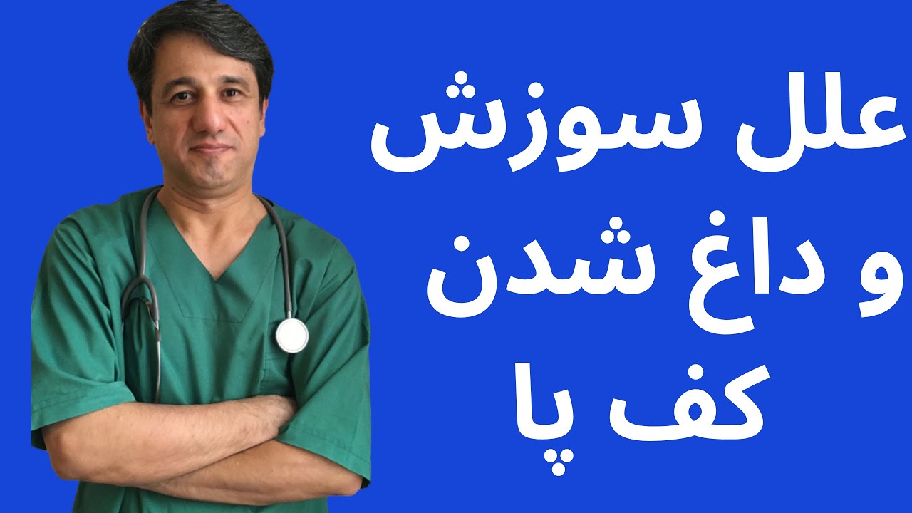 داغی کف پا و سوزش کف پا (بررسی تمام علل احتمالی) - با زیرنویس فارسی