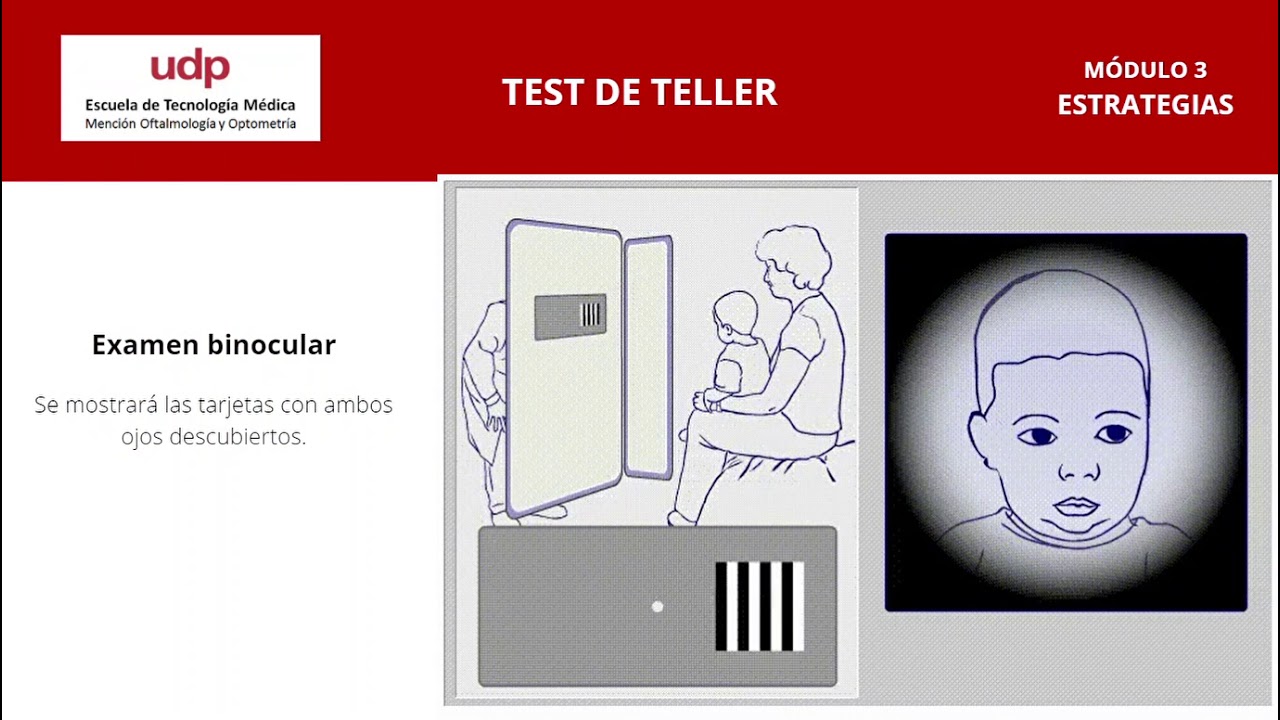 TEST DE LA MIRADA PREFERENCIAL - TELLER