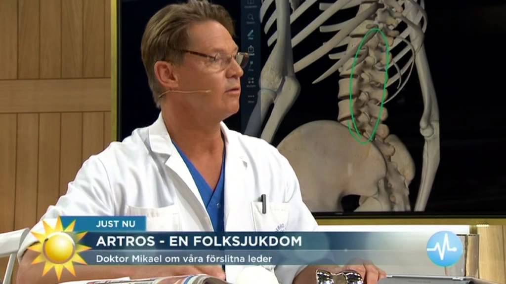 Artros - en folksjukdom - Nyhetsmorgon (TV4)