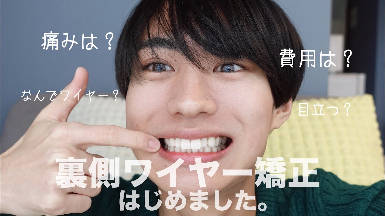 【歯列矯正】ワイヤー表側矯正をはじめました🦷