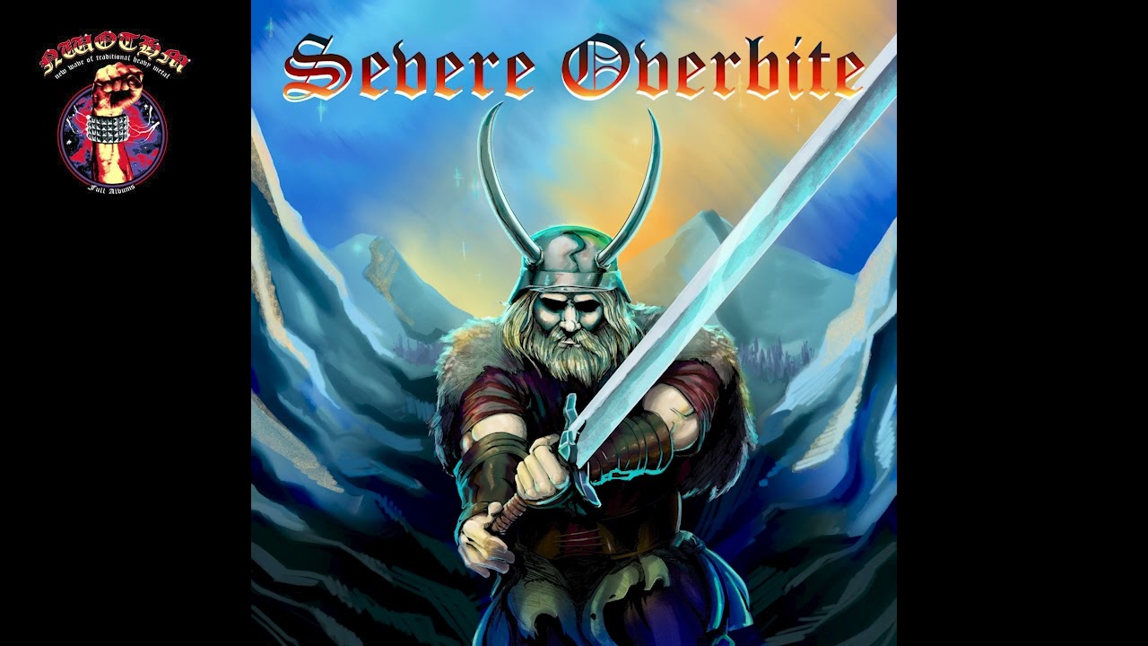 Severe Overbite - Severe Overbite (2024)