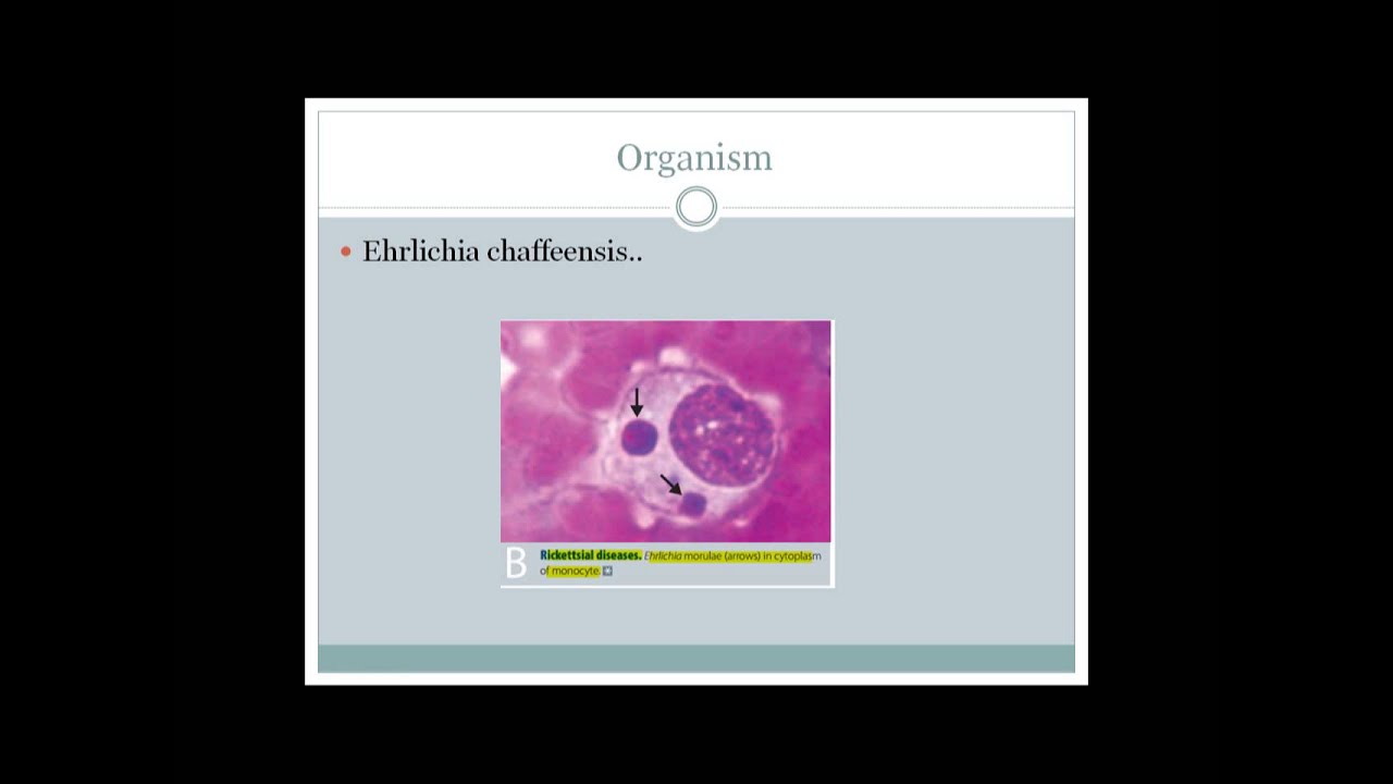 Ehrlichiosis (An integrated discussion for USMLE step 1)