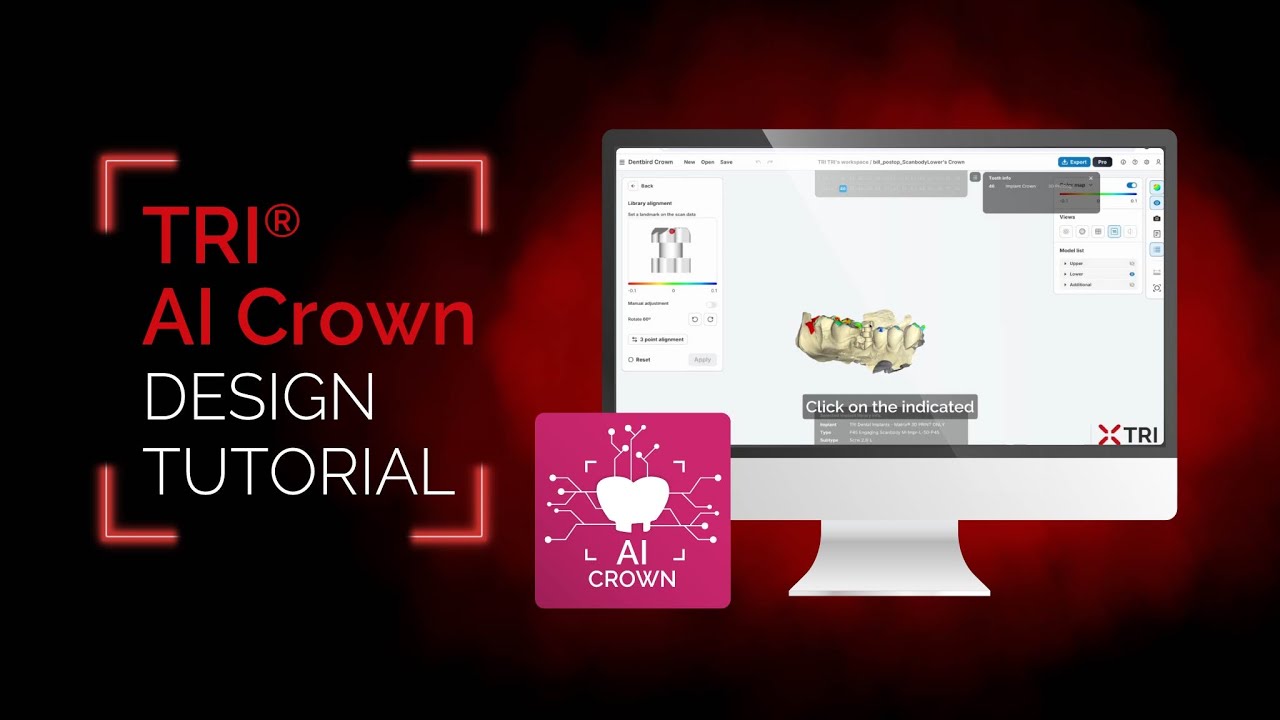 TRI&reg; AI Crown Design Tutorial | AI-Powered Crown Design on Implant Level | matrix&reg; System