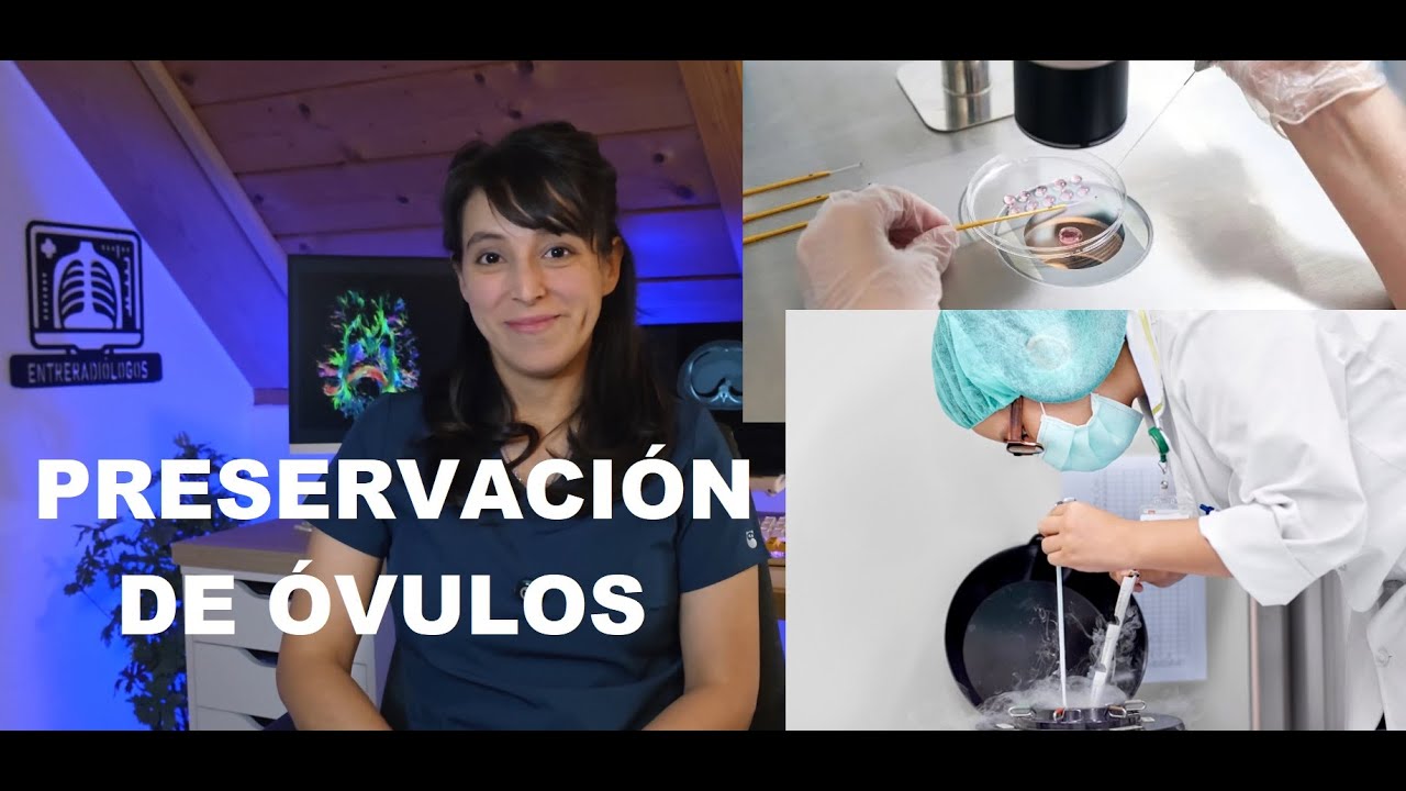 Mi experiencia preservando óvulos. Respondo tus preguntas.