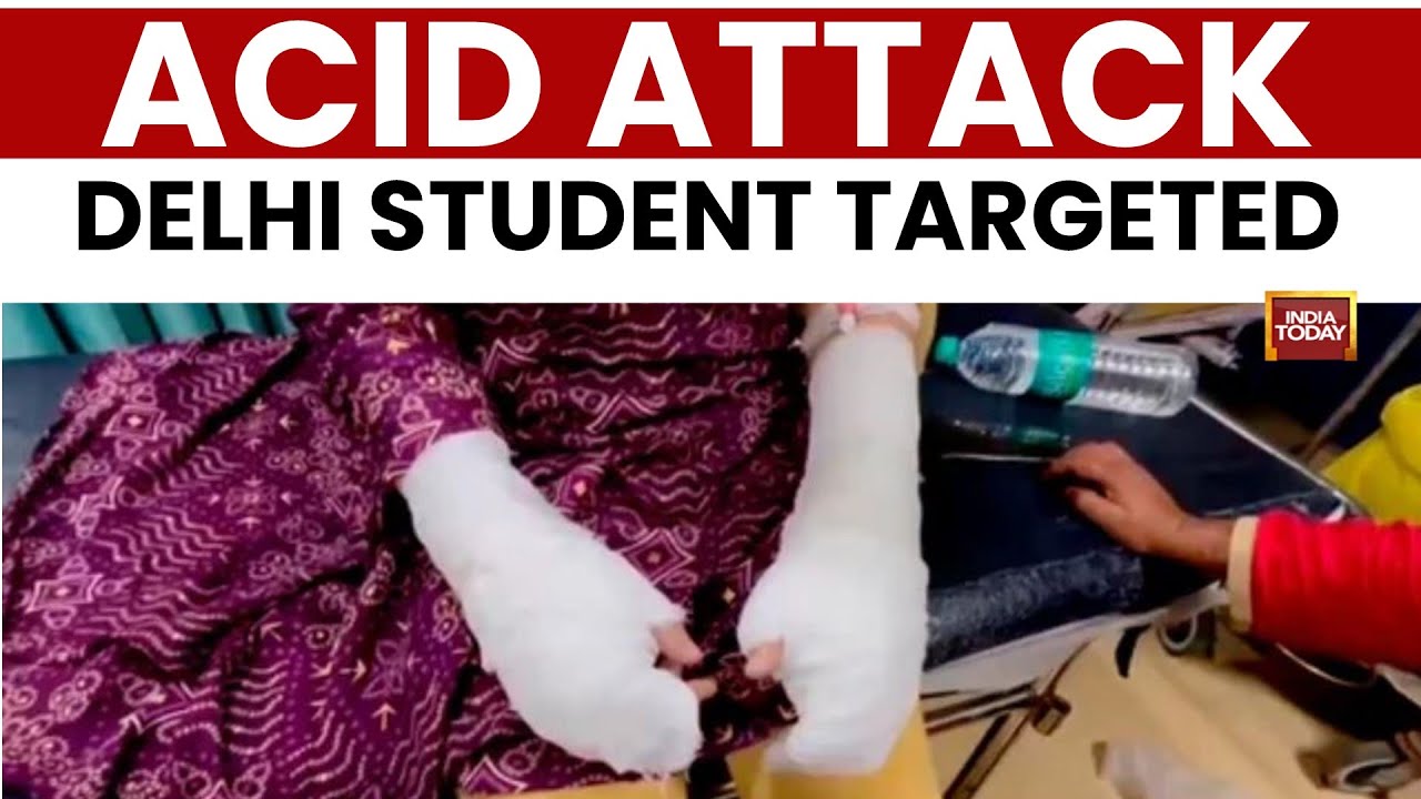 Delhi Acid Attack Horror: Stalker, 2 others throw acid on DU student near her college | India Today