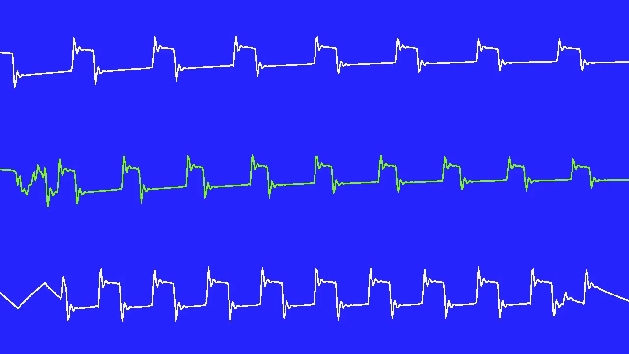 COMMODORE C64 SID - SYS64738 DAYS - LINUS - 2018 - X18 (Oscilloscope View)