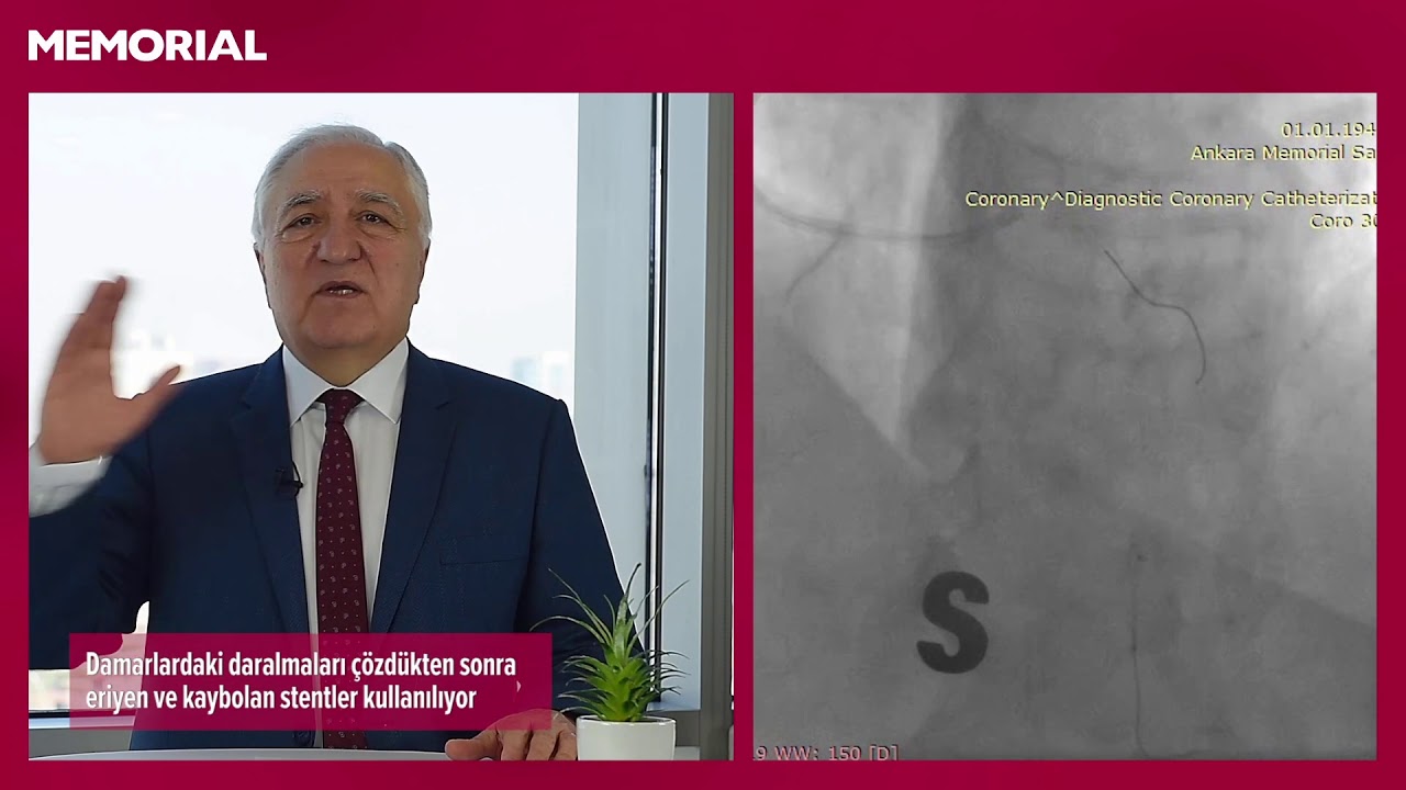 Kalpteki damar daralması nasıl tedavi ediliyor? - Prof. Dr. Ali Oto (Kardiyoloji Uz.)