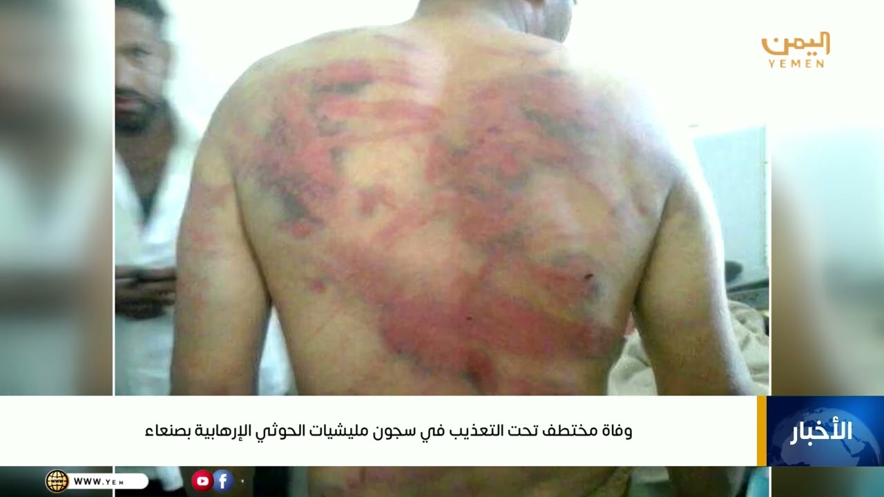 وفاة مختطف تحت التعذيب في سجون مليشيات الحوثي الارهابية بصنعاء