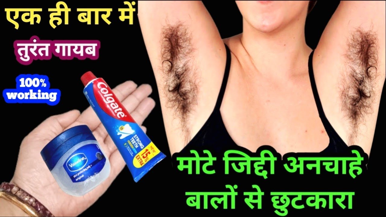 सिर्फ दो बूंद में दाढ़ी, मूछ गायब तुरंत 😱 अनचाहे बालों का समाधान II facial hair treatment in Hindi 