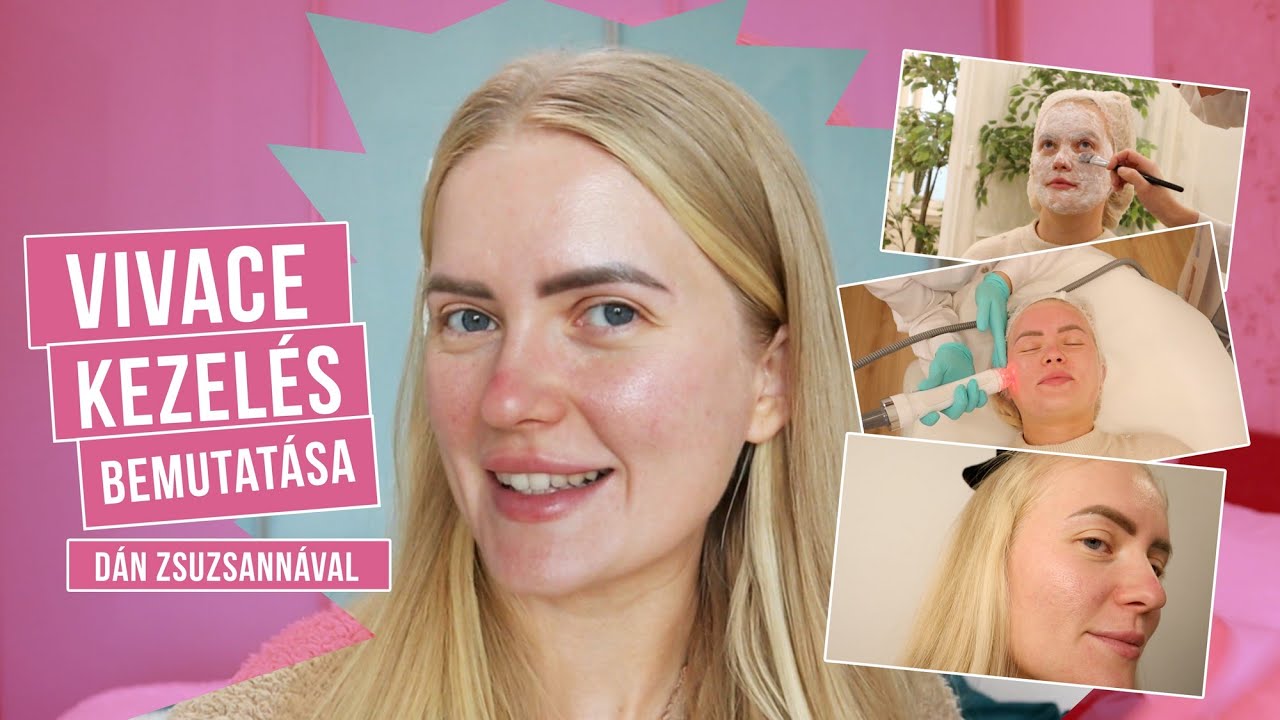 VIVACE MIKROTŰS, RÁDIÓFREKVENCIÁS KEZELÉS BEMUTATÁSA