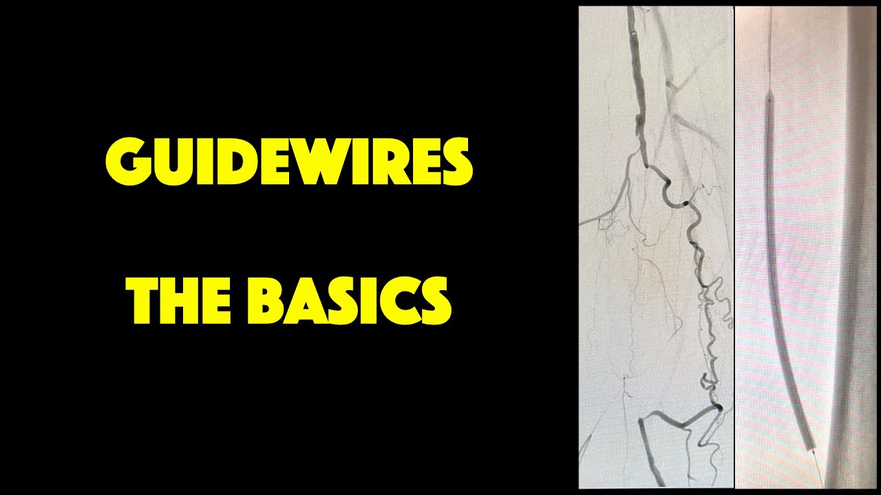 Guidewires: The Basics