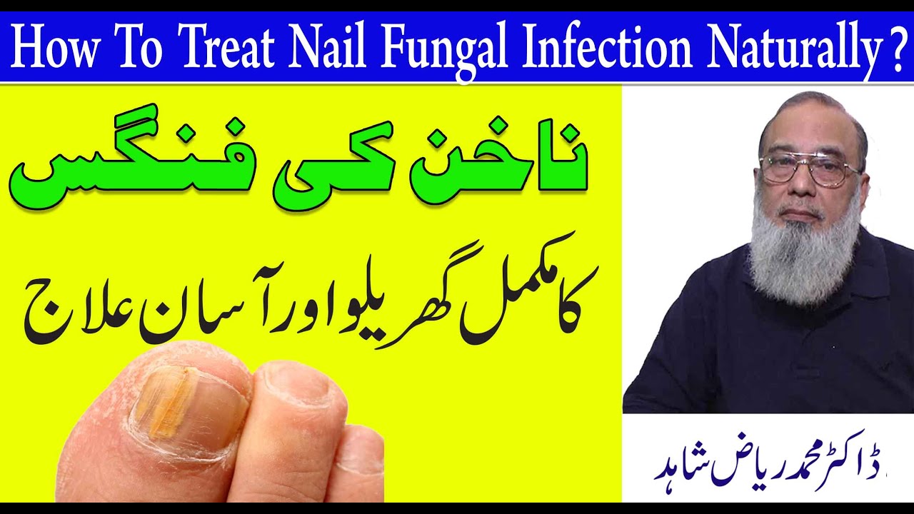 How To Treat Nail Fungal Infection Naturally