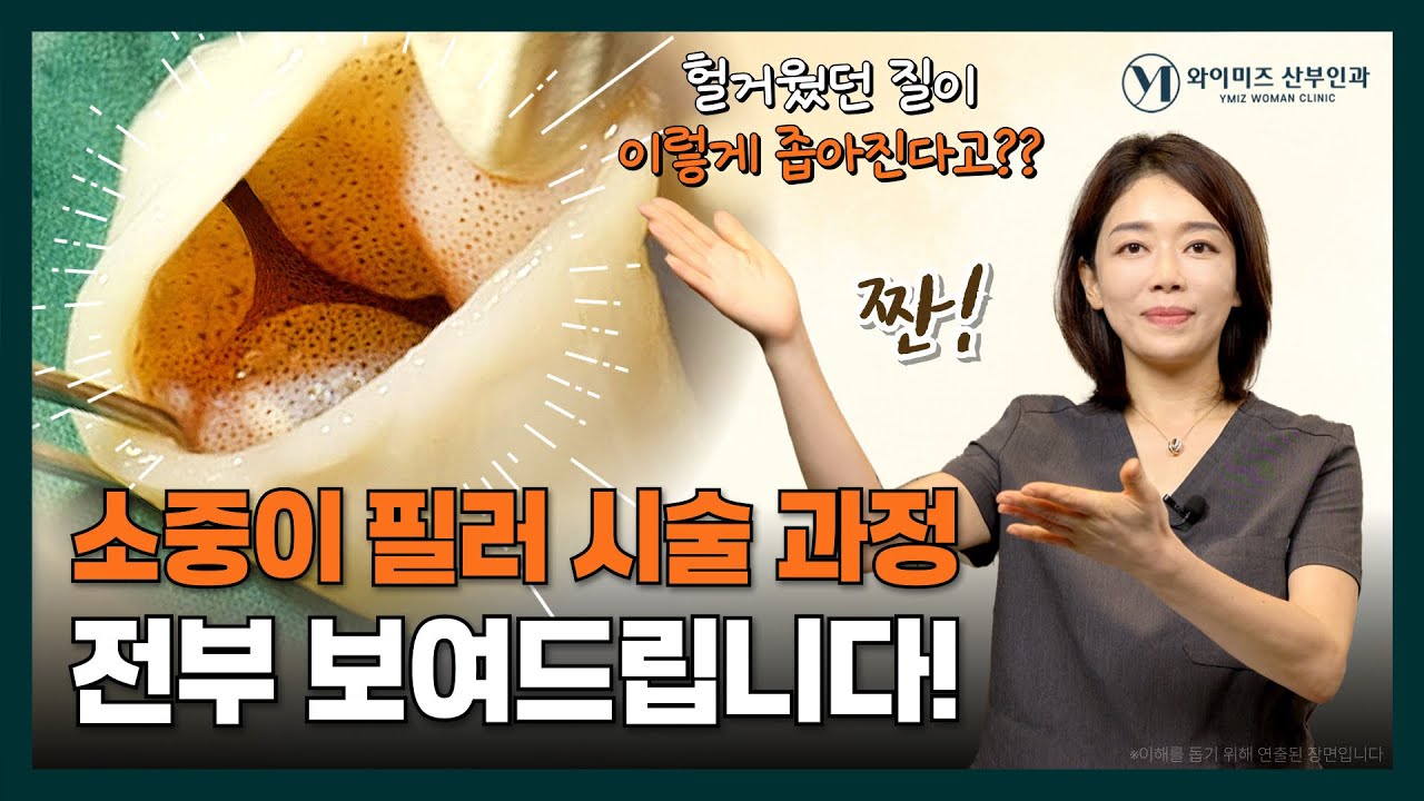 질필러 시술 과정 직접 다 보여드립니다! 꽉~찬 느낌 느끼는 방법! 