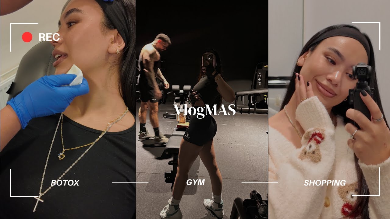 VLOGmas 2 | Masseter Botoks Yaptırdım💉| Hollanda'da Botoks & Dolgu Fiyatları