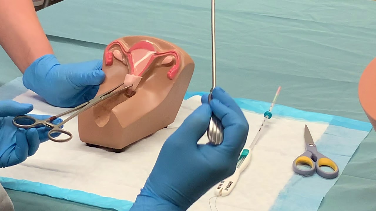 Gynecologic Procedures Mirena