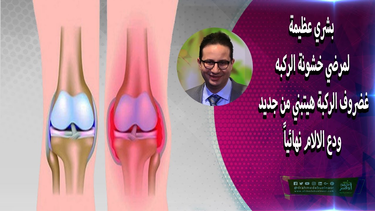 بشري عظيمة لمرضي خشونة الركبه غضروف الركبة هيتبني من جديد ودع الالام نهائياً