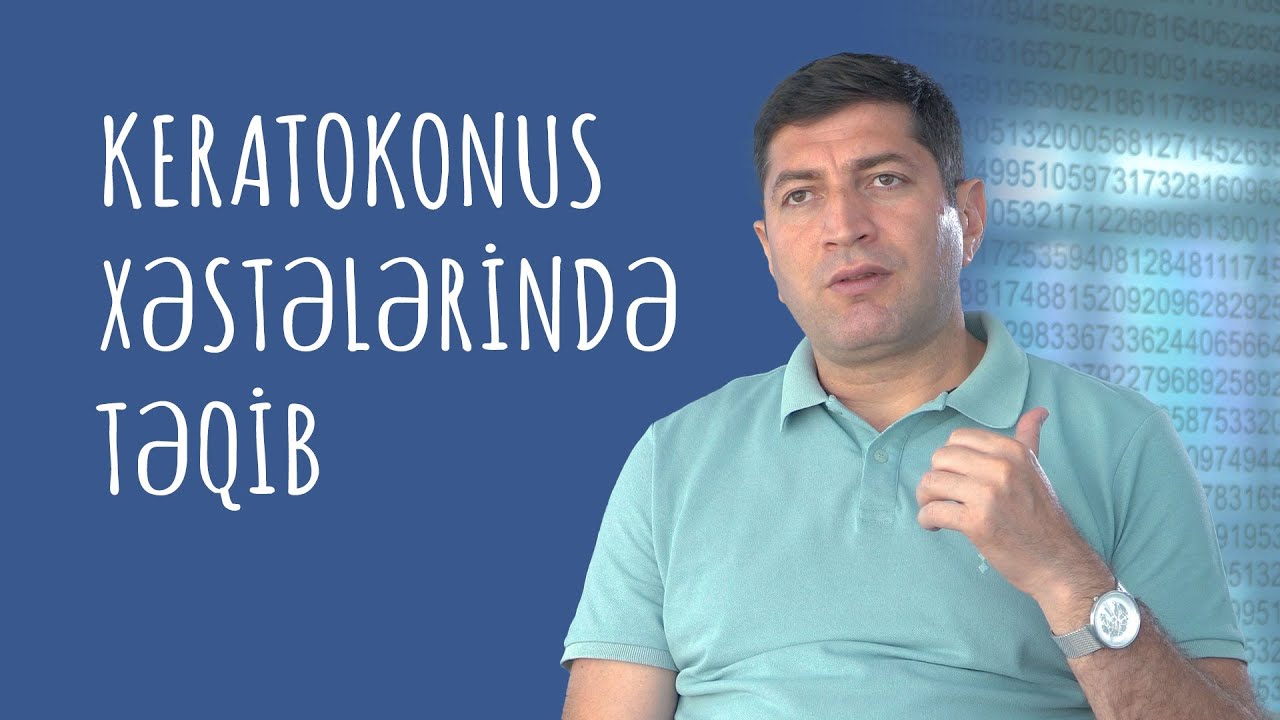 Keratokonus xəstələrində təqib necə olmalıdır? #RafadarXalilov #Keratokonus