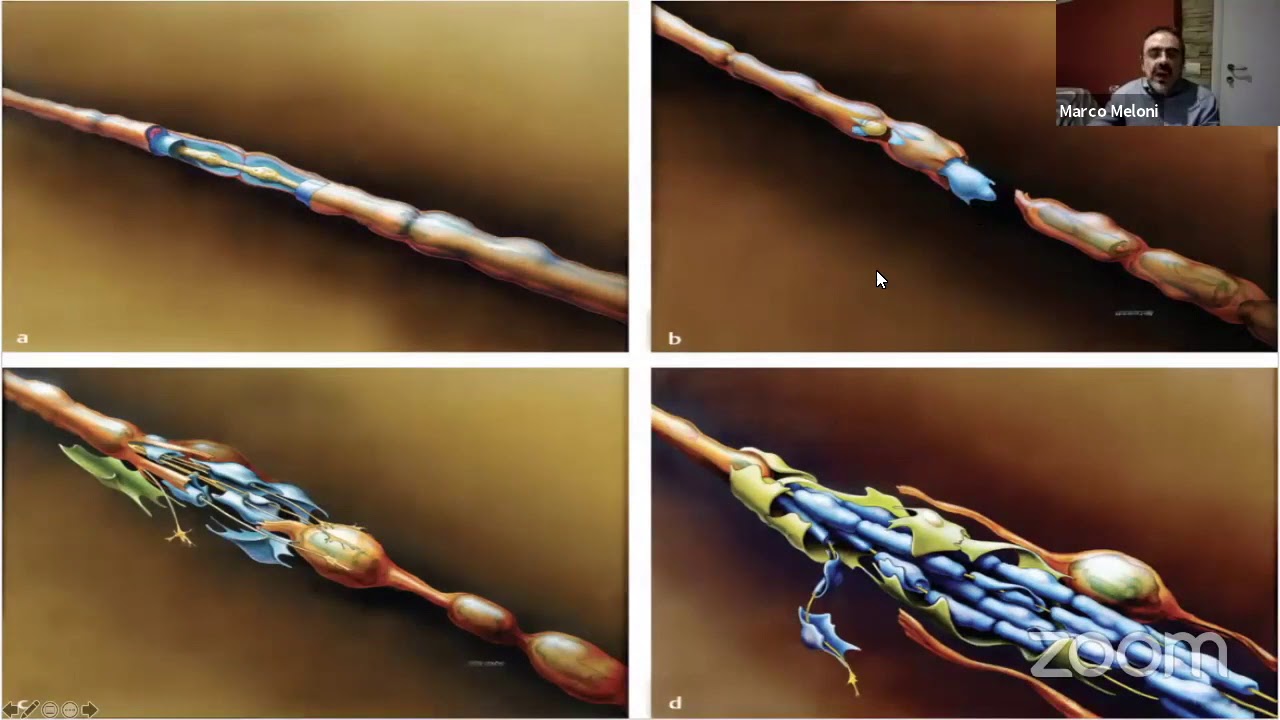 Peripheral Nerve Surgery: Basic Principles