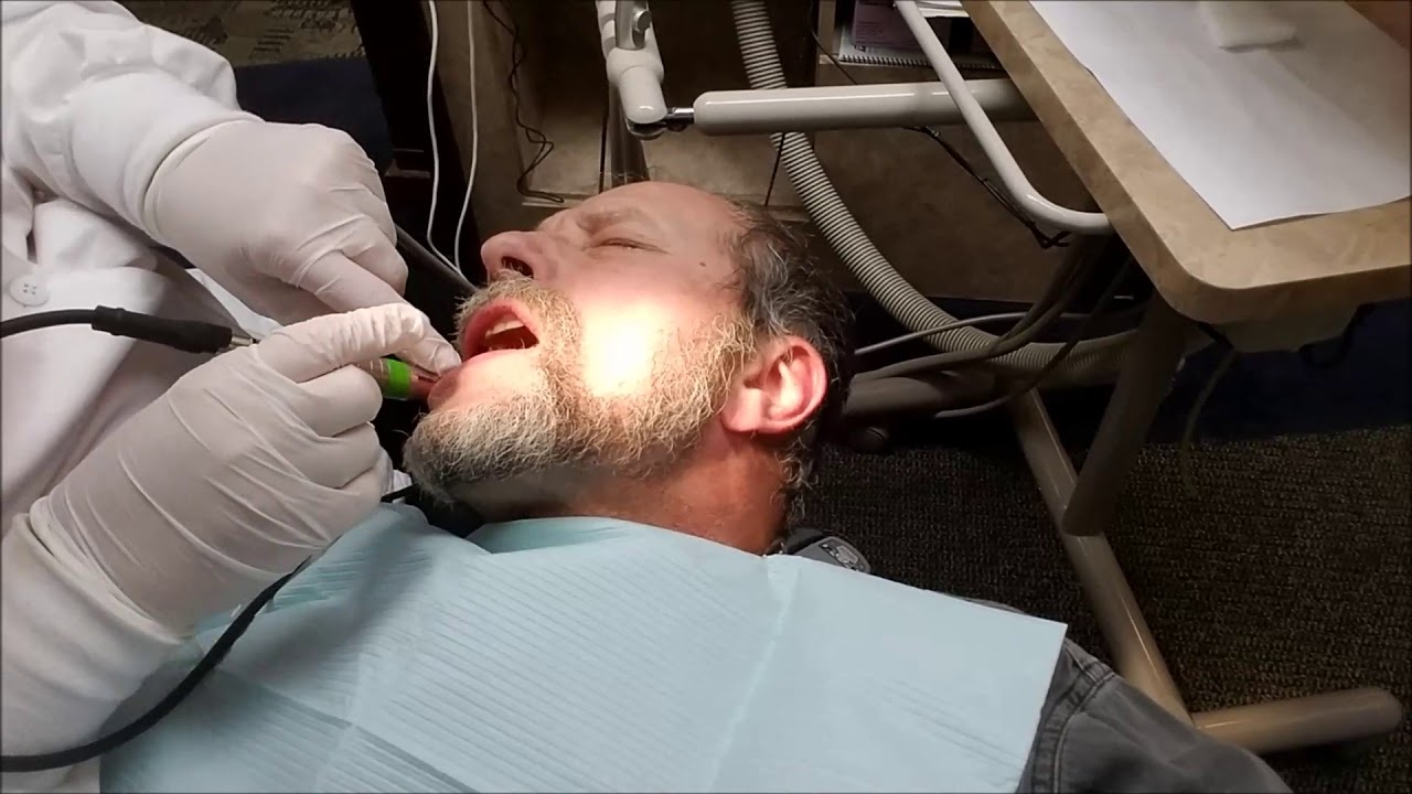 Deep Cleaning Pt2 of The Numbing