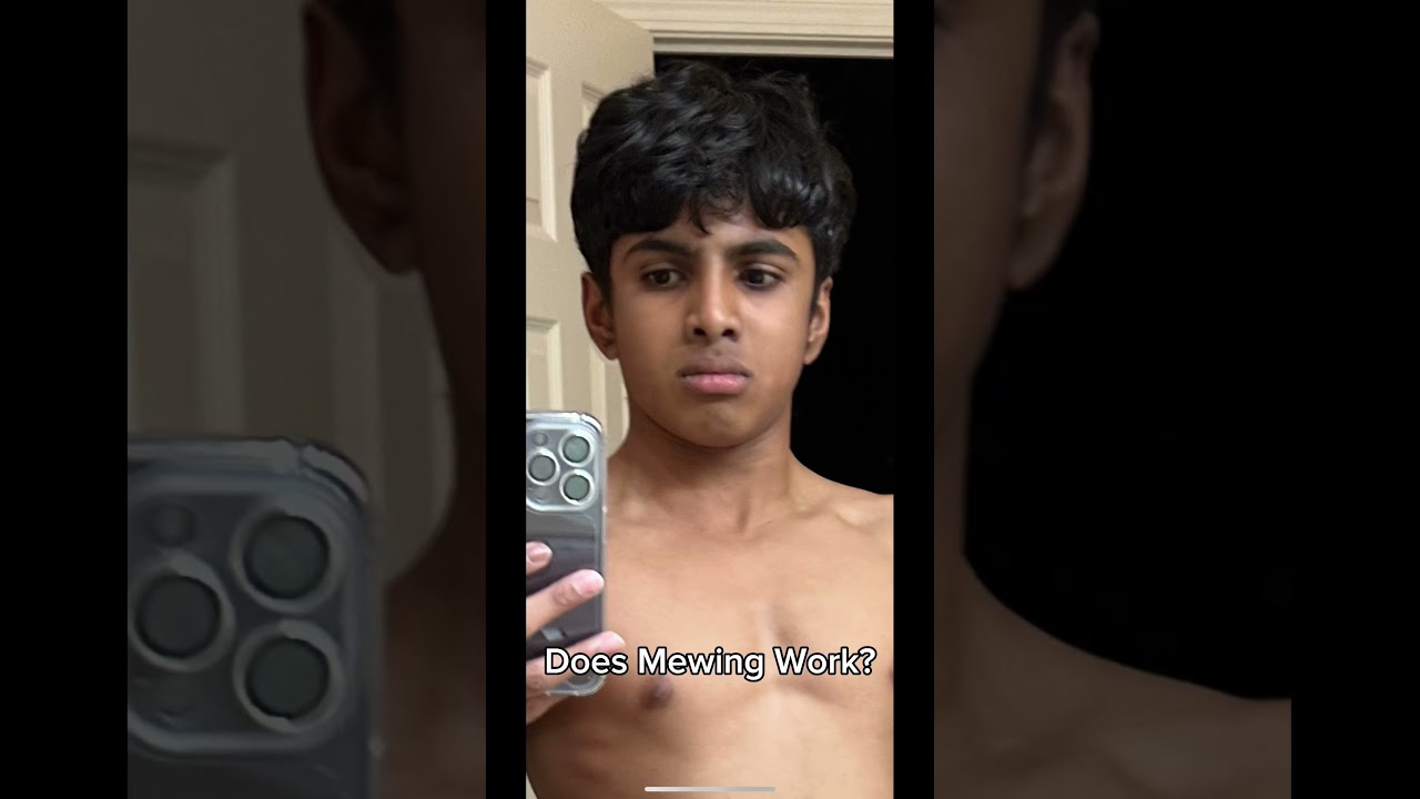 My 1 Year Mewing Transformation