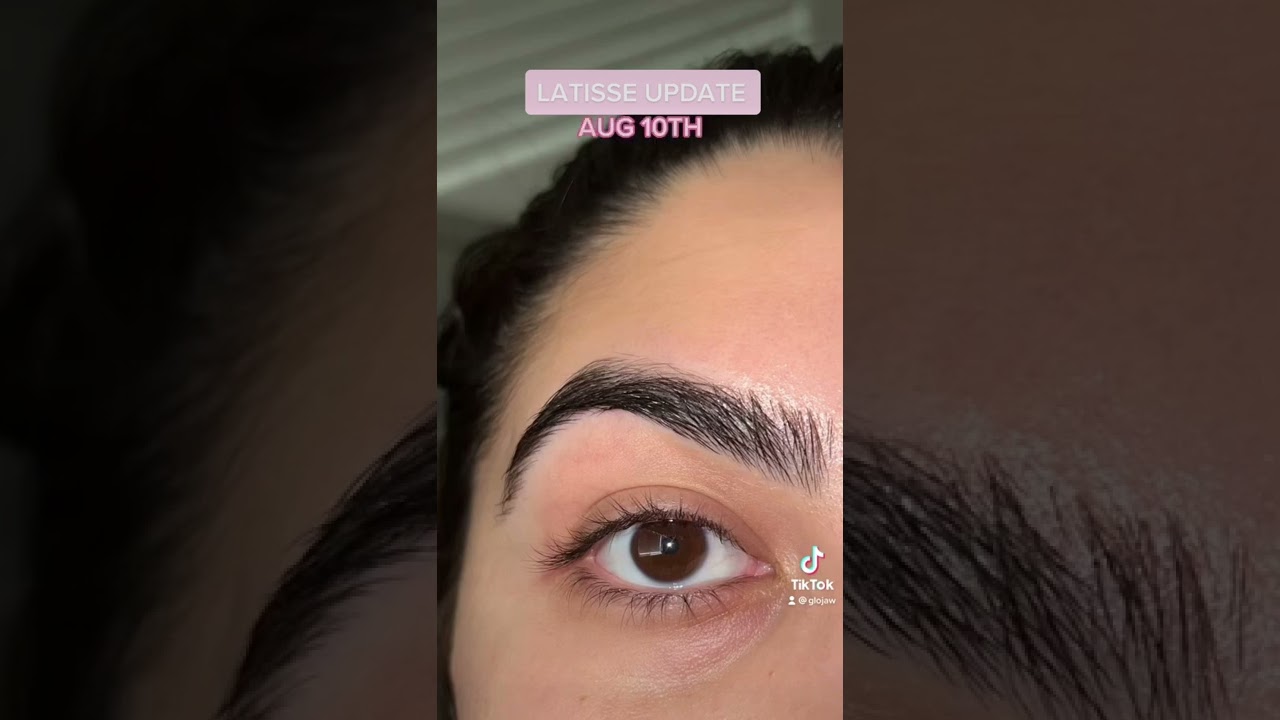 LATISSE UPDATE #shorts #youtubeshorts #latisse #eyelashes