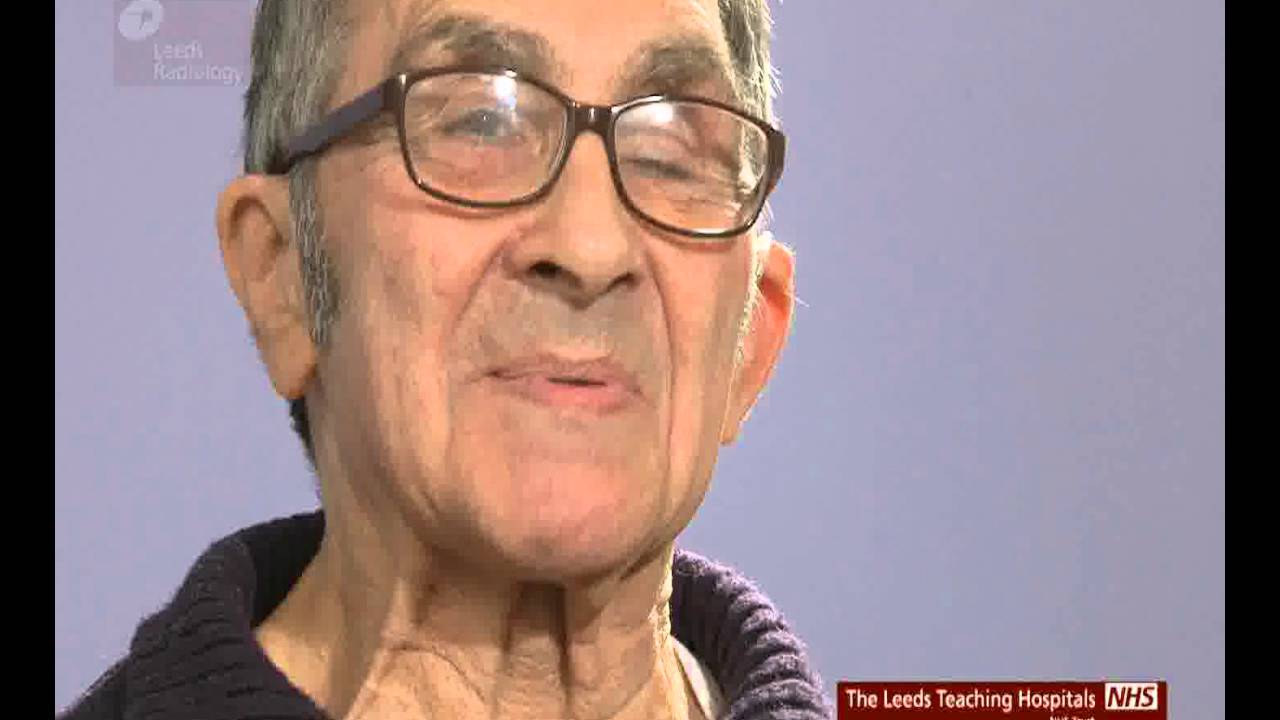 Patient Story - John Brett - Cryoablation of the Kidney
