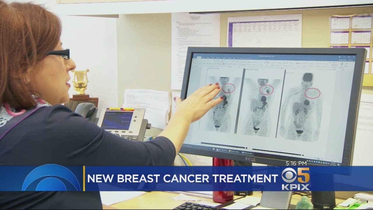 New Treatment Shows Promise For Triple-Negative Breast Cancer Patients