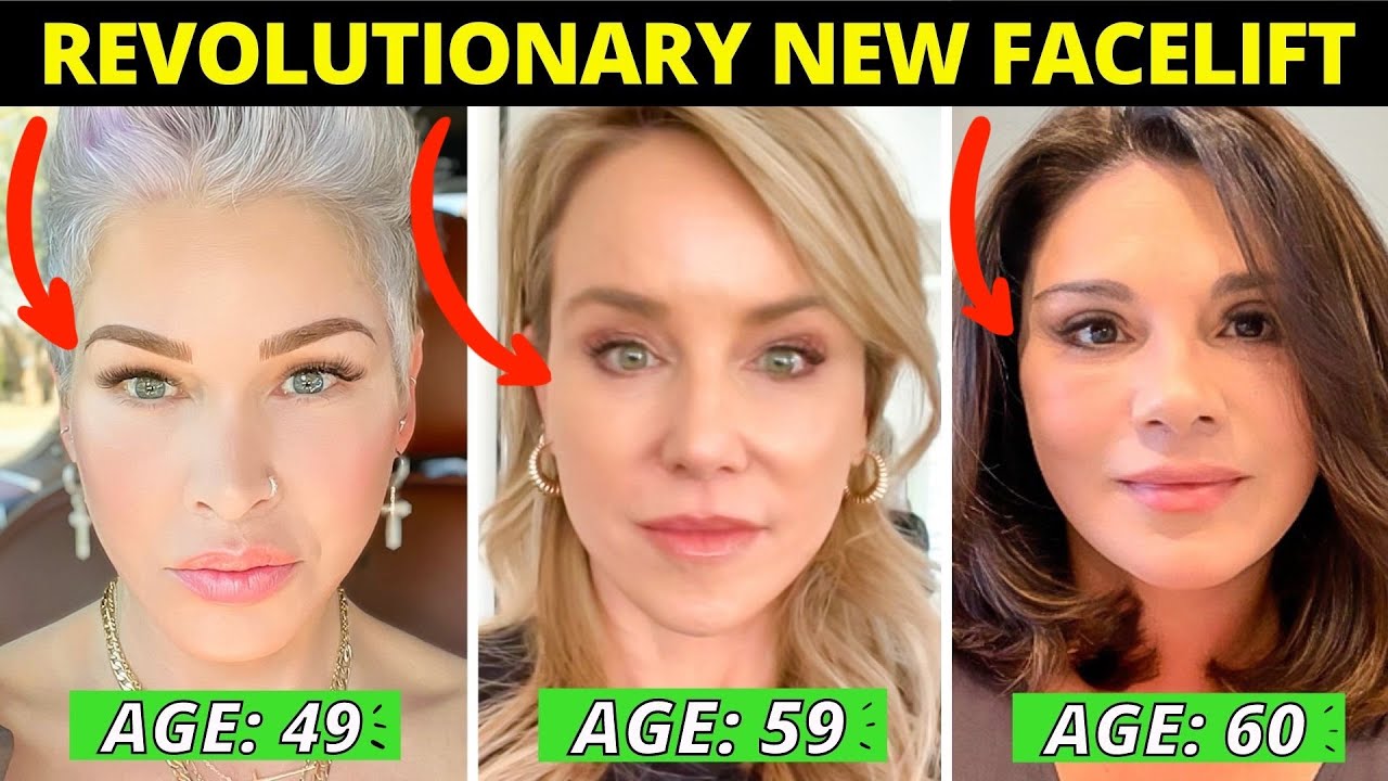 Revolutionary Facelift Alternative?! Better AND Longer Lasting Results (Vertical Restore Facelift)