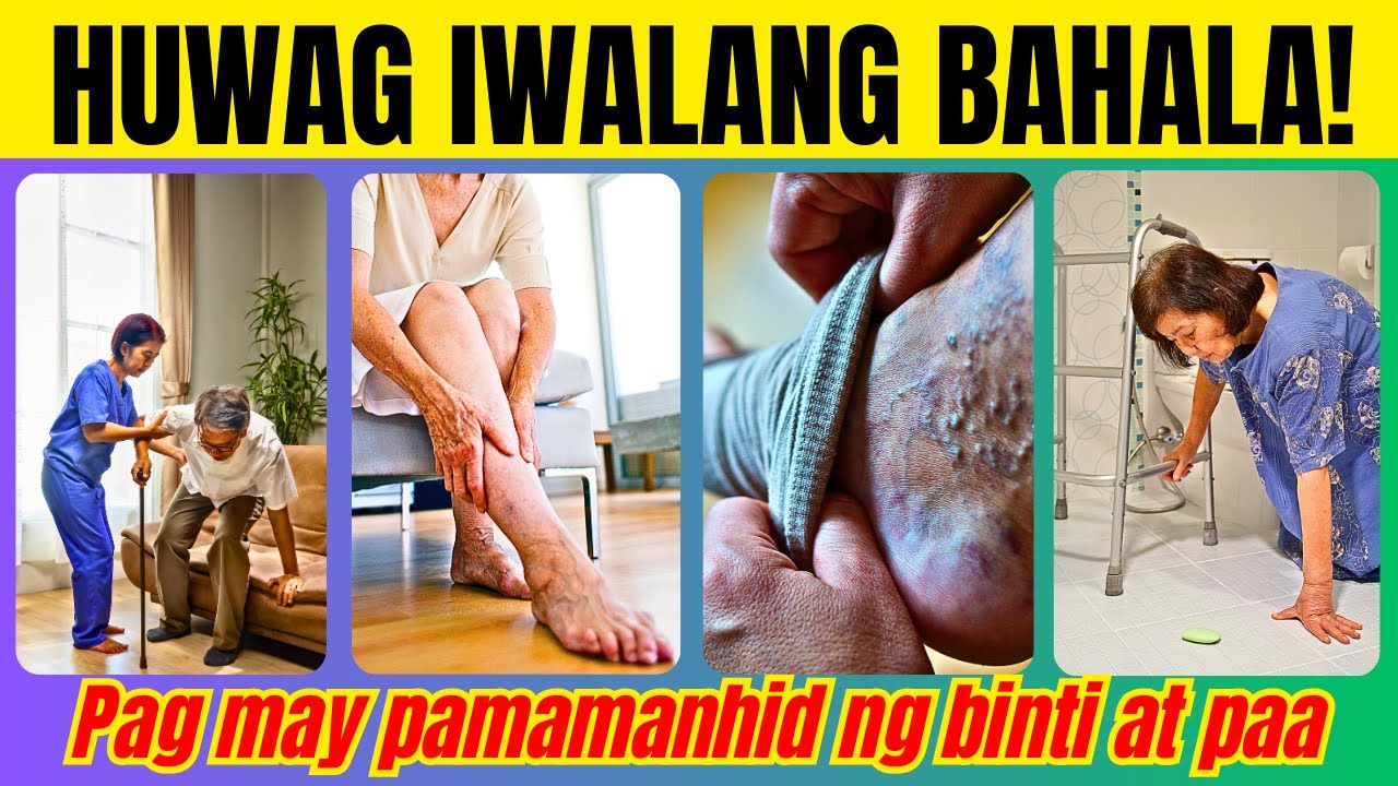 5 SINTOMAS na HUWAG Mong IWALANG BAHALA sa PAMAMANHID ng BINTI at PAA (Neuropathy) | Doc Cherry