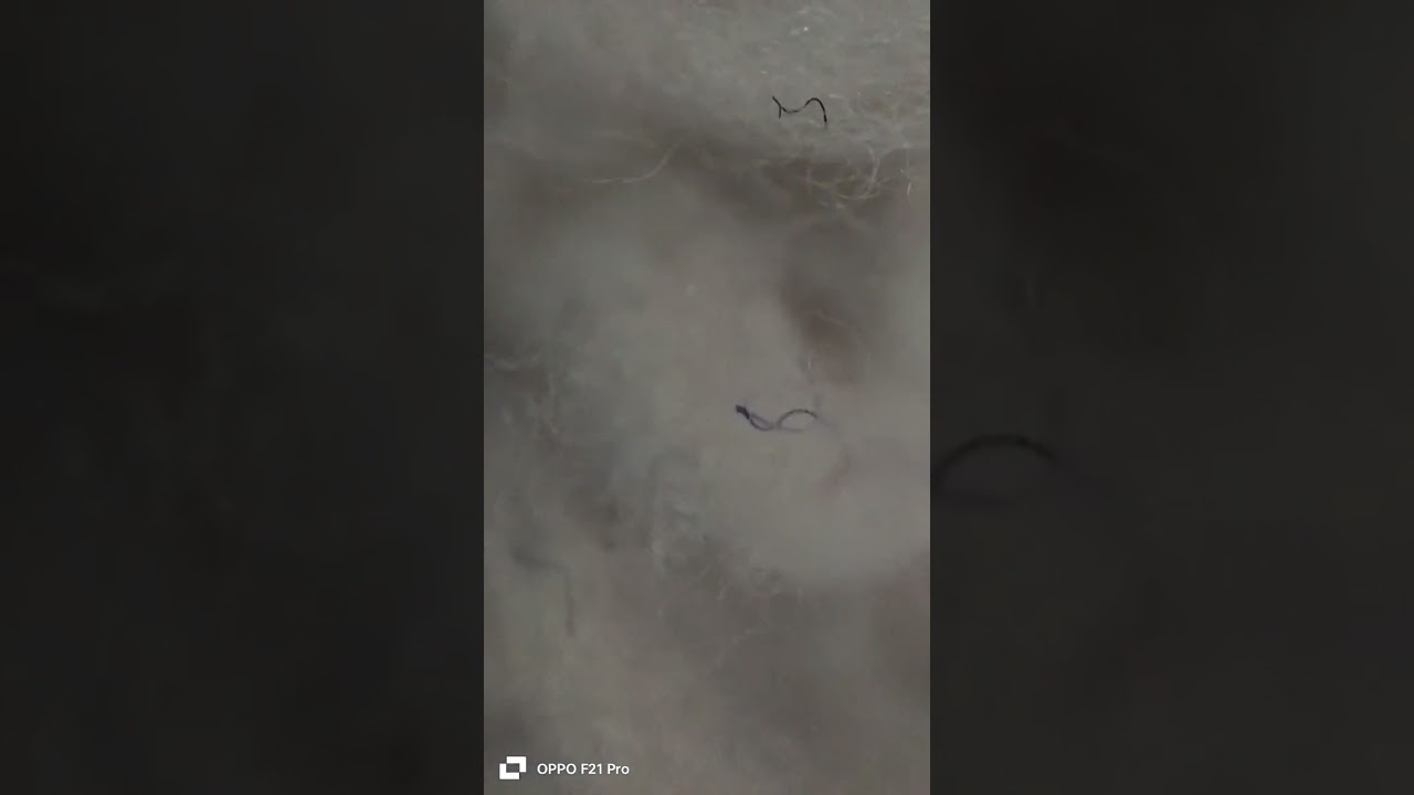 my blanket in microscope tell me what next #microboy #shorts #viral