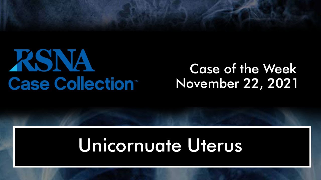 Case of the Week: Unicornuate Uterus