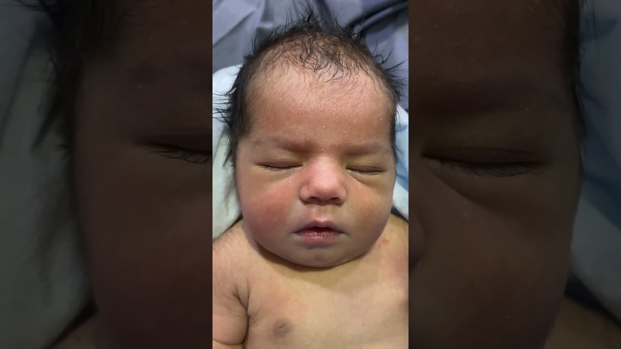 Cute NICU Baby Recovered from Neonatal Jaundice 💛 Nurse Love & Care 🤲❤️