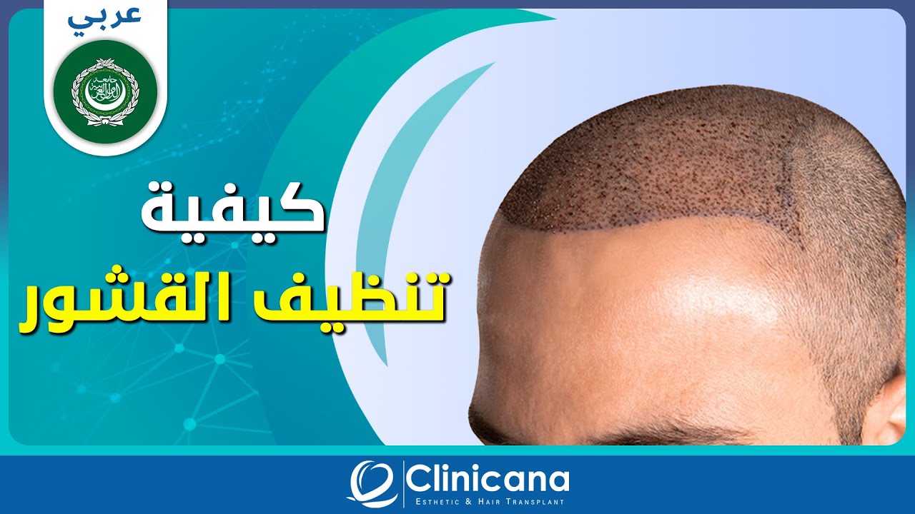 كيفية تنظيف القشور بعد 11 يوم من عملية زراعة الشعر