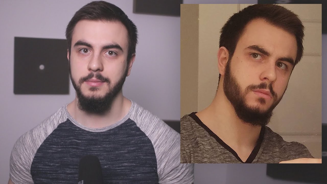 Yoke Training, Jawline Tricks, Shyness (Q&A)