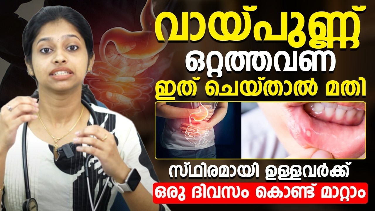 ഒറ്റ തവണ ഇതു ചെയ്താൽ നിങ്ങളുടെ വായ്പ്പുണ്ണ് പൂർണ്ണമായി മാറ്റിയെടുക്കാം