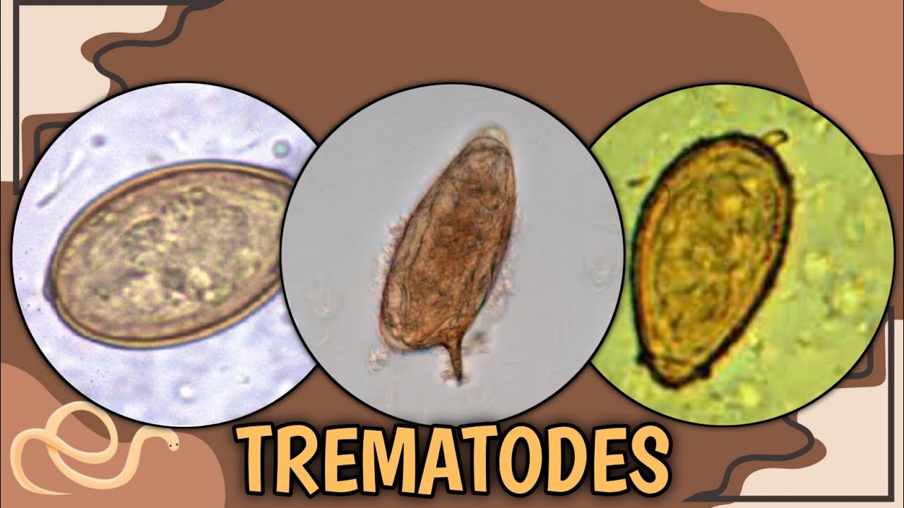 Parasitology Quiz #3 | Trematodes