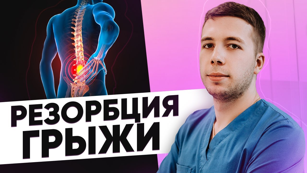 Грыжа ПОЗВОНОЧНИКА L4-L5. Полная резорбция (рассасывание) грыжи. МРТ до и после лечения
