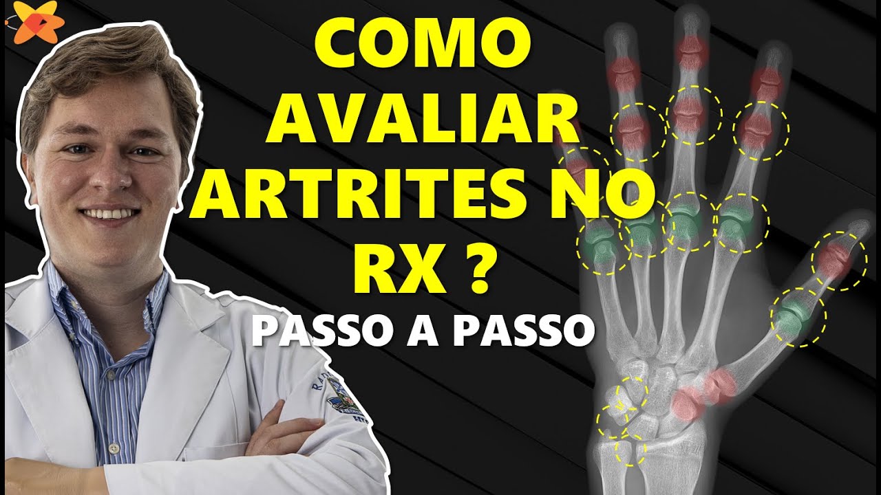 RADIOLOGIA APLICADA À REUMATOLOGIA | Sessão conjunta VR e LIRES