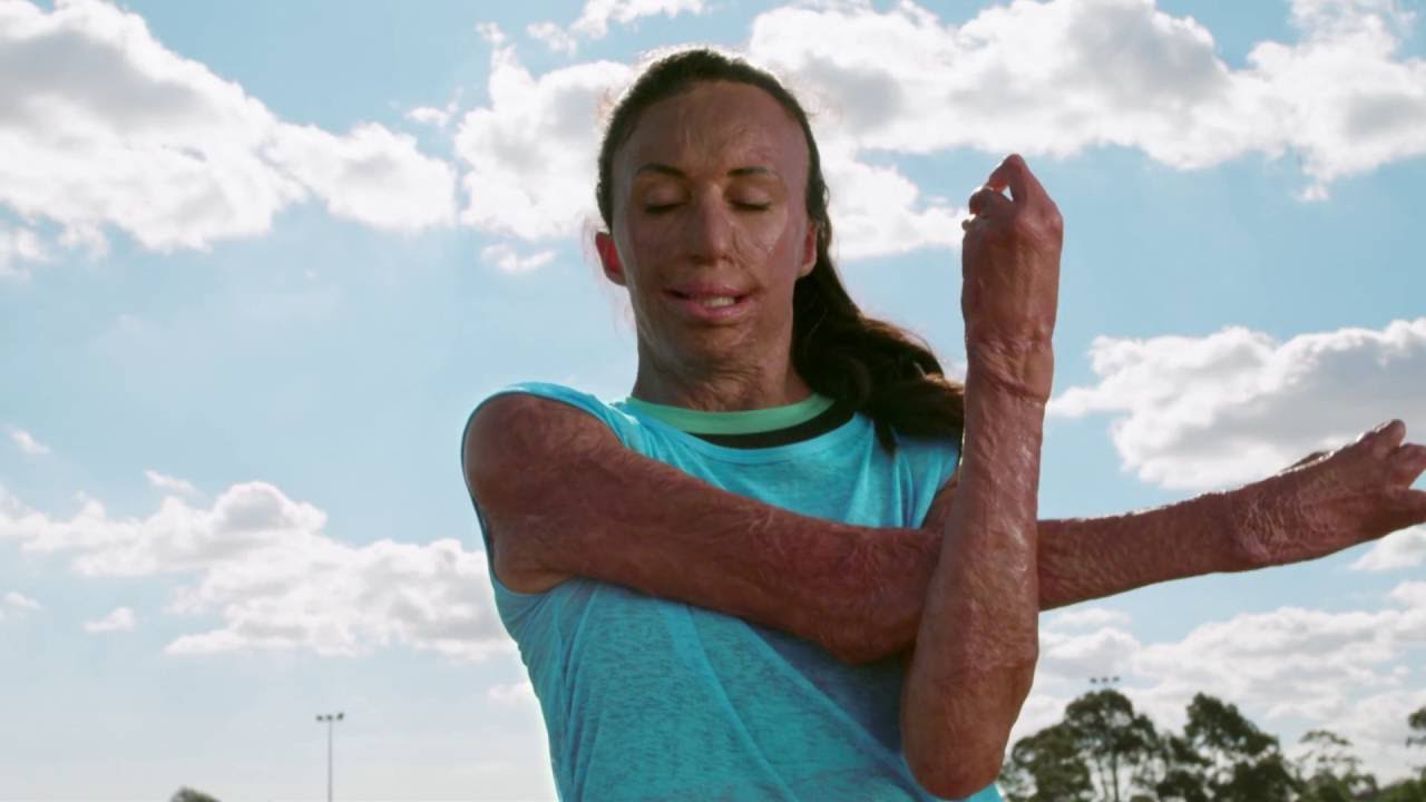 Dream Big, Princess | #IDareToDreamBig with Turia Pitt