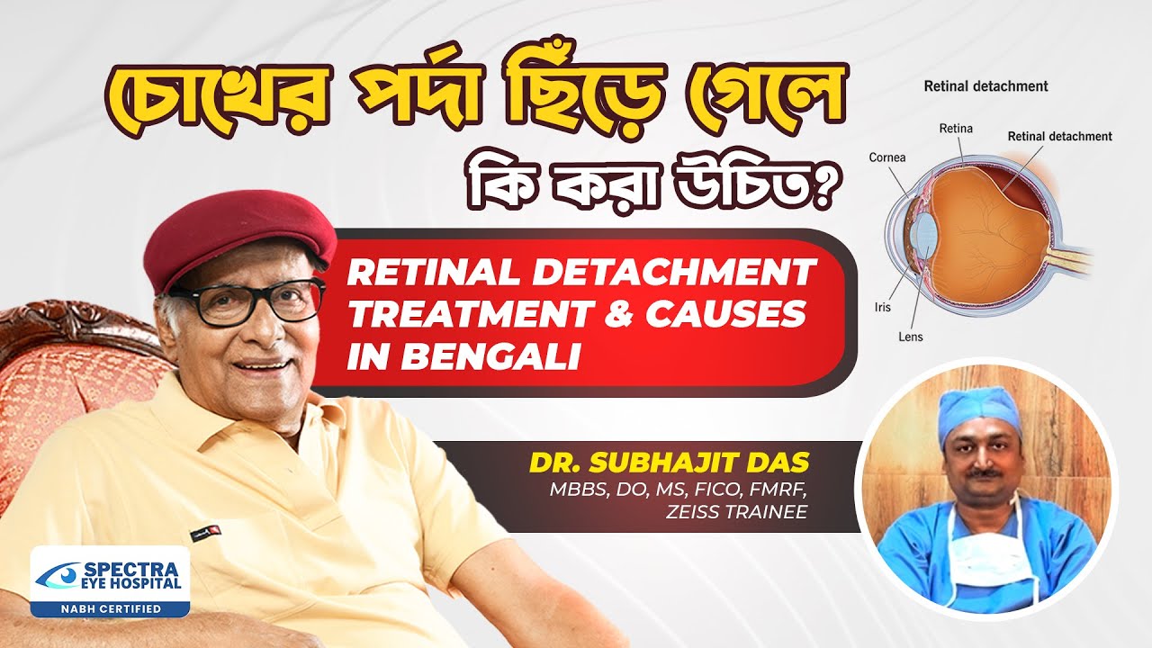 Retinal Detachment In Bengali: Treatment & Causes | চোখের পর্দা ছিঁড়ে গেলে কি হয়? Dr Subhajit Das