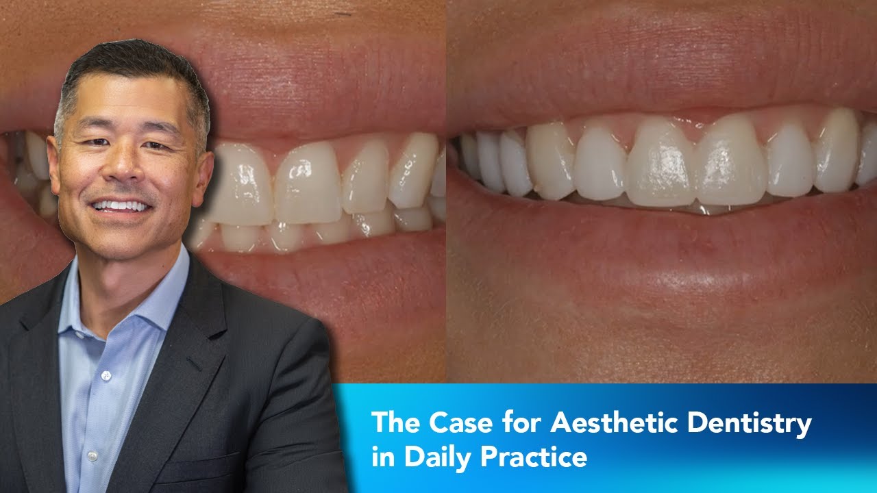 The Case for Aesthetic Dentistry in Daily Practice | Dentist 2 Dentist