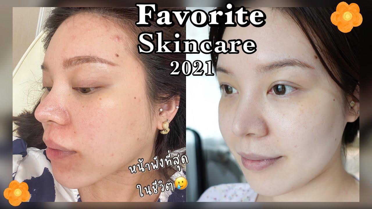 FAV. SKINCARE 2021 ปีที่ผิวเปลี่ยนสุดๆ ท้อง สิวบุก ผิวอ่อนแอ กลับมาใสแล้ว เย่!║Evefee