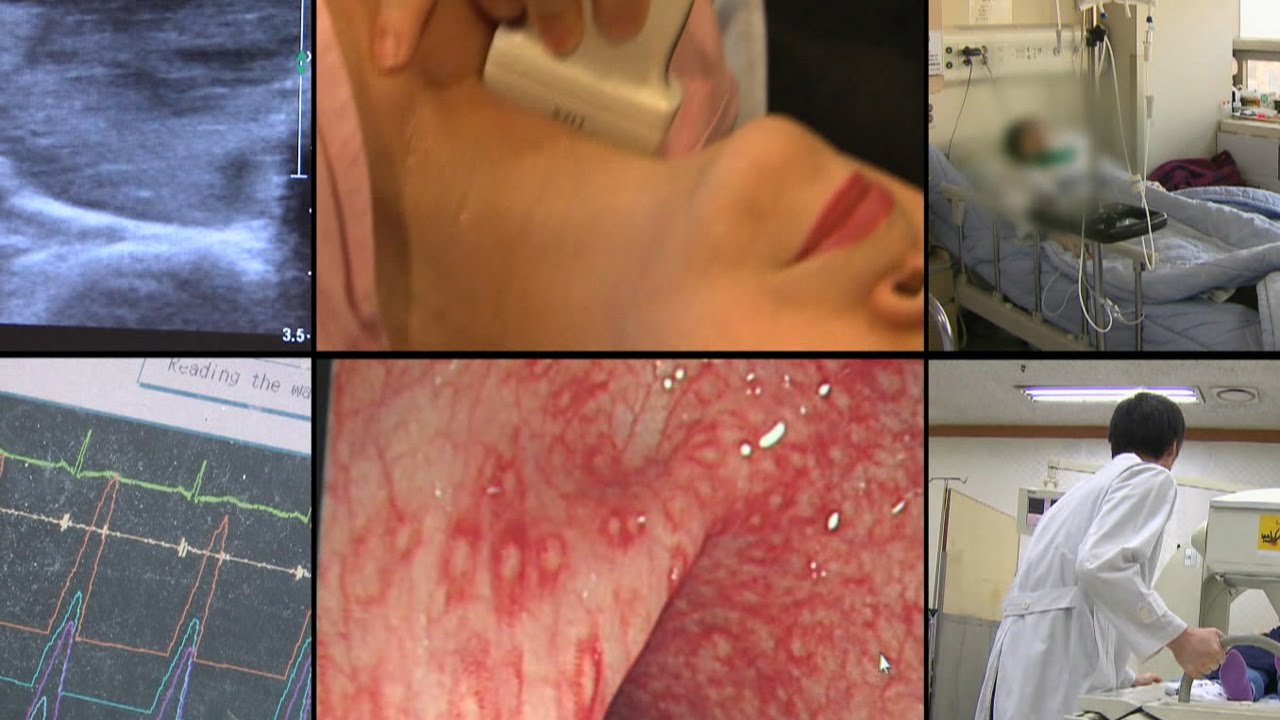 과잉진료 논란 '갑상생암' 환자들의 올바른 선택은? (건강특급) @좋은아침 4689회 20150914