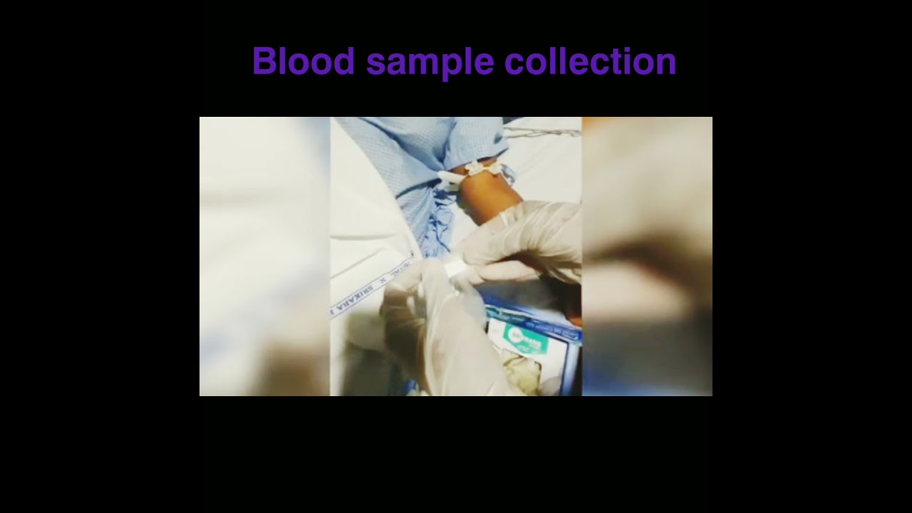 $𝗮𝗳𝗲 𝗮𝗻𝗱 𝗲𝗳𝗳𝗲𝗰𝘁𝗶𝘃𝗲 --𝗯𝗹𝗼𝗼𝗱 𝘀𝗮𝗺𝗽𝗹𝗲 𝗰𝗼𝗹𝗹𝗲𝗰𝘁𝗶𝗼𝗻 ---𝘁𝗲𝗰𝗵𝗻𝗶𝗾𝘂𝗲𝘀## 𝗯𝘆 𝘀𝘆𝗿𝗶𝗻𝗴𝗲💉💉###