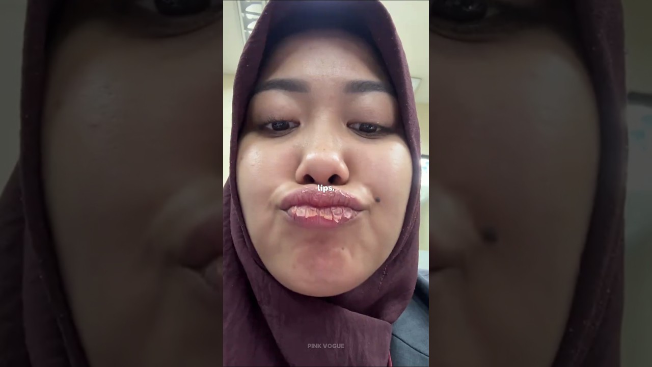 💁🏻&zwj;♀️MUST-KNOW Winter Hacks for Dry Skin & Lips!❄️😱(Goodbye Flakes!)#shorts #winter #hack