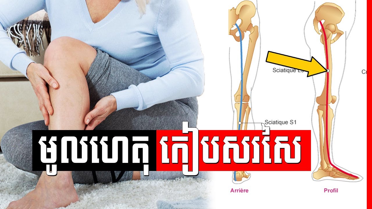 ស្យ៉ាទិក សរសៃដ៏ធំជាងគេបង្អស់ក្នុងសរីរាង្គកាយមនុស្ស , DOULEURS AUX JAMBES