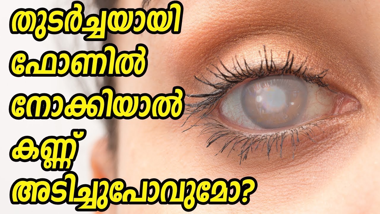 കണ്ണ് അടിച്ചുപോവുമോ? Smartphone increase risk of blindness