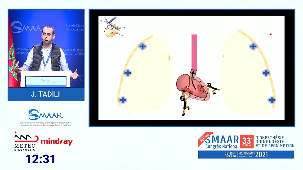 Les interactions cardiopulmonaires: un atout ou un obstacle pour l'anesthésiste? Symposium SMAAR 33e